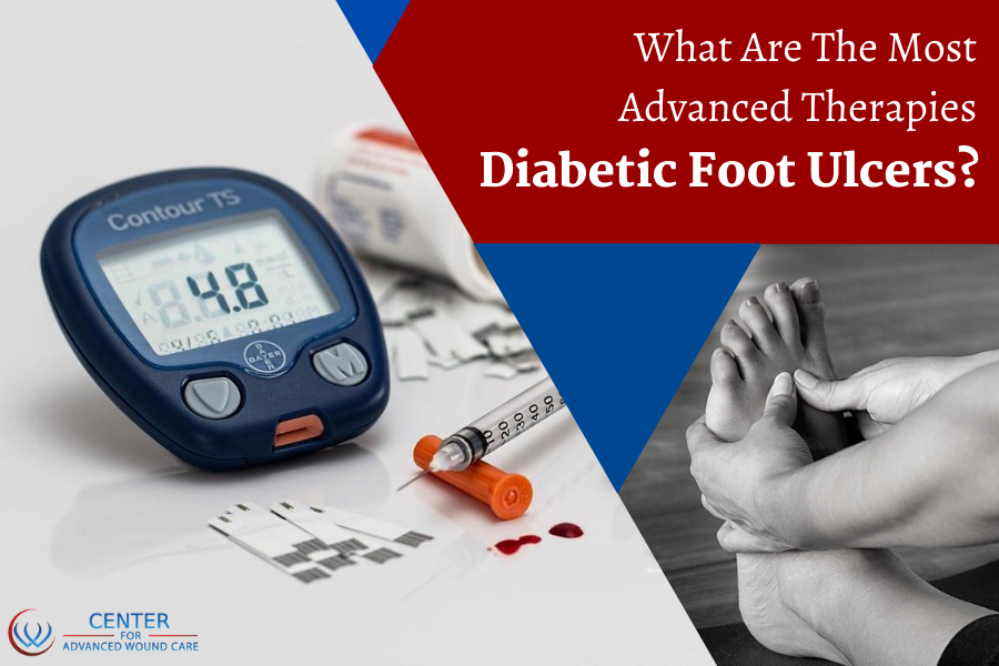 Diabetic leg ulcer clinic Ventura