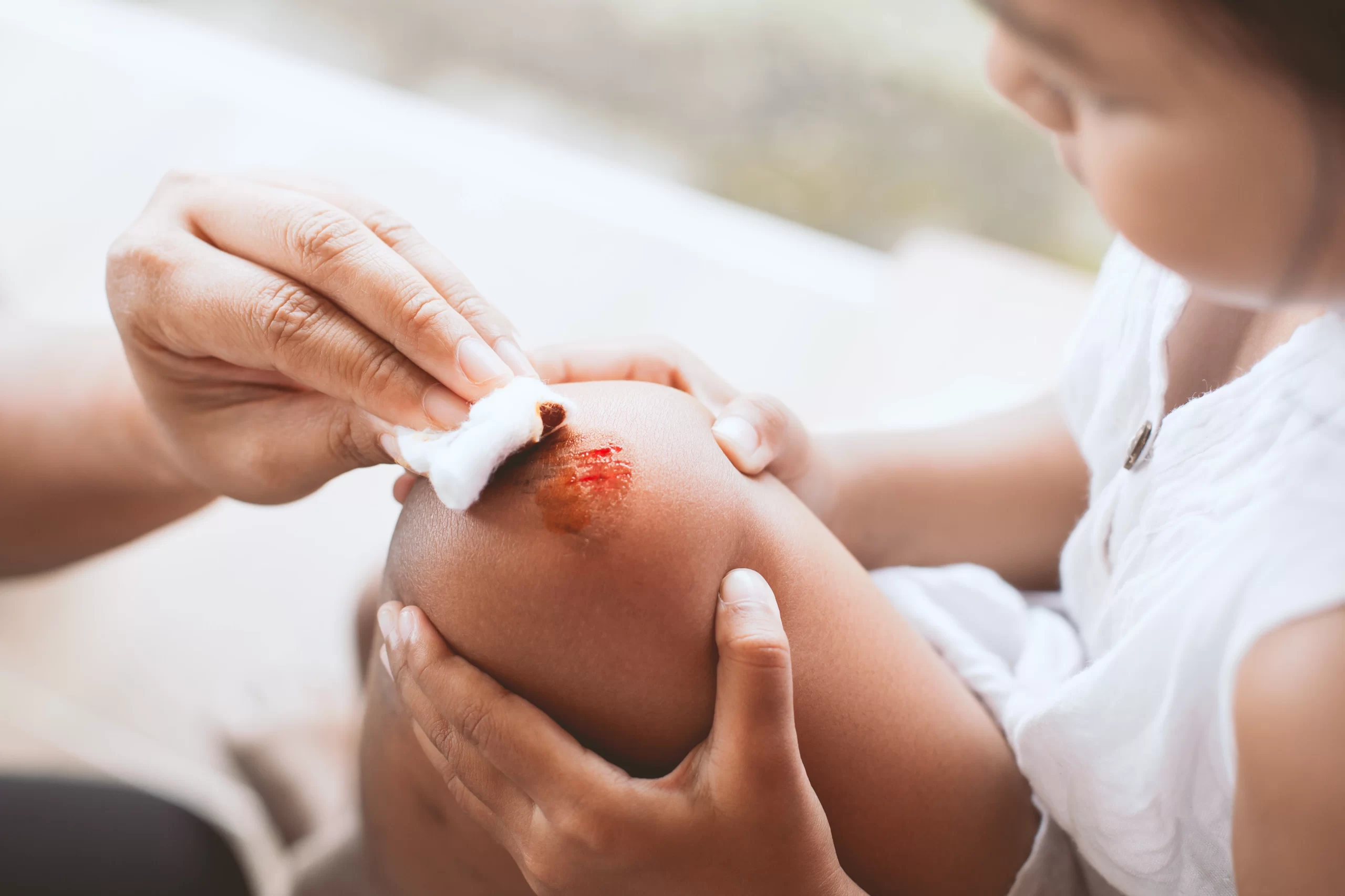 Adult hand cleaning a child’s scraped knee with cotton, providing first aid for a fresh wound.