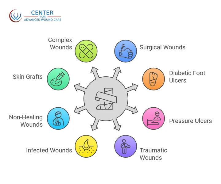 Diagram explaining negative pressure wound therapy uses for different wound types