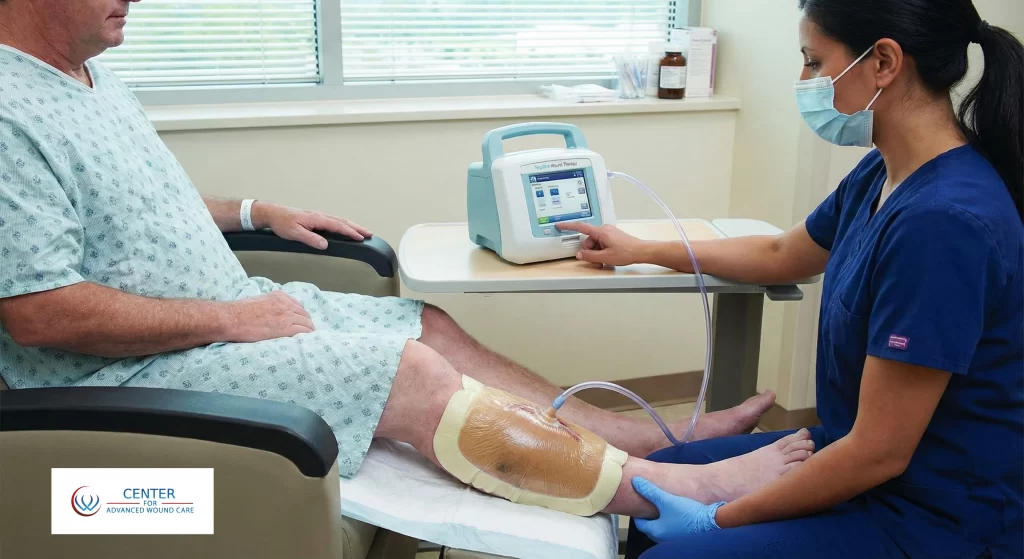 Nurse applying Negative Pressure Wound Therapy (NPWT) to a patient's leg using a wound vacuum device in a clinical setting at the Centre for Advanced Wound Care.